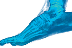 Budowa i znaczenie stopy w mechanizmie chodzenia