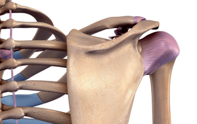 Czym jest dyskineza łopatki?