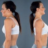 Terapia manualna skolioz u dorosłych