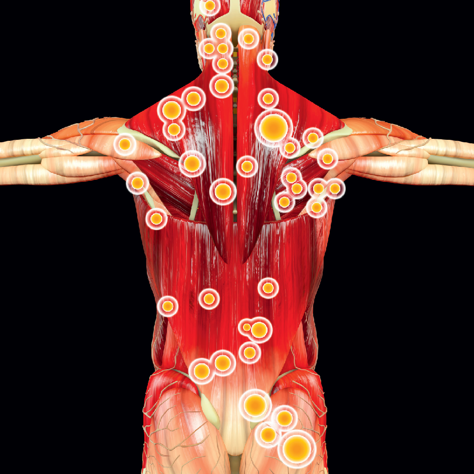 Lokalizacja głównych wybranych punktów spustowych układu mięśniowo-szkieletowego