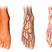 Ból mechaniczny a typ stopy