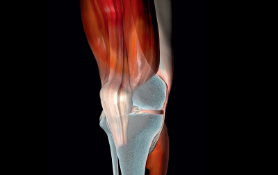 Zespół bólowy przedniego aspektu kolana