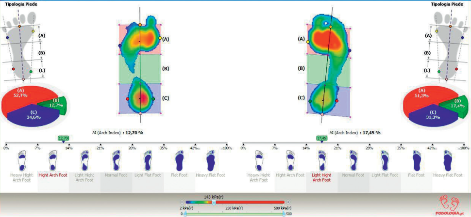 Obraz z komputera ukazujący przebieg badania pedobarograficznego (FootComfort).