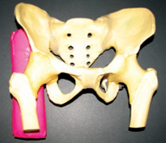 Sztywny wałek styropianowy umieszczony pionowo pod prawym krętarzem modelu anatomicznego.