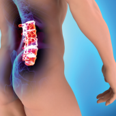 Gimnastyka terapeutyczna u pacjentów z kostno-chrzęstnymi zmianami zwyrodnieniowymi kręgosłupa