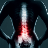 Kinezyterapia odruchowa w zmianach degeneracyjno-dystroficznych kręgosłupa