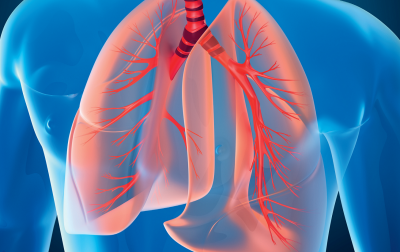 Rehabilitacja oddechowa u osób z przewlekłymi chorobami płuc