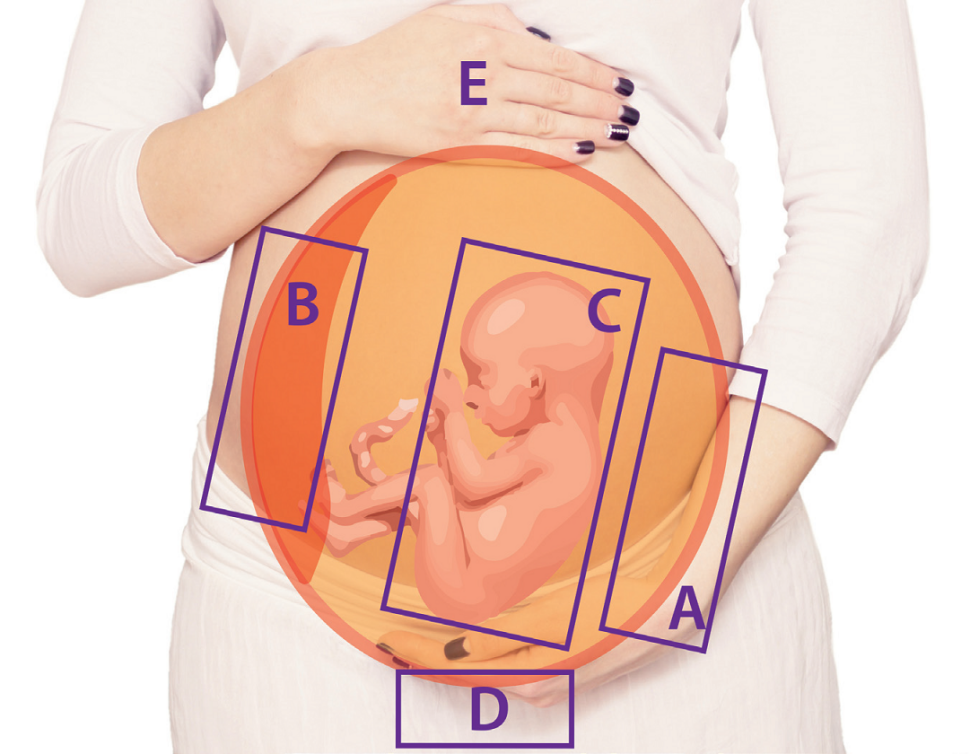 Grafika przedstawiająca możliwe lokalizacje traumy u kobiety w ciąży