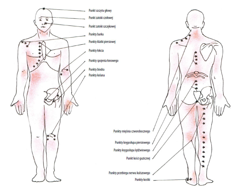 Drugorzędne punkty Knapa