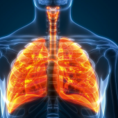 Ambulatoryjny program rehabilitacji oddechowej w przypadku zespołu po zatorowości płucnej