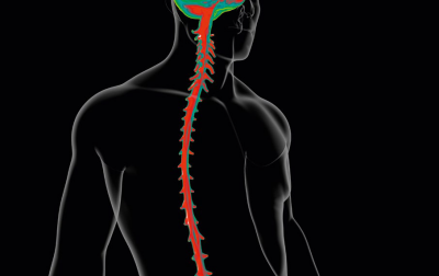 Terapia manualna w niekorzystnym napięciu nerwowym opony twardej i rdzenia kręgowego