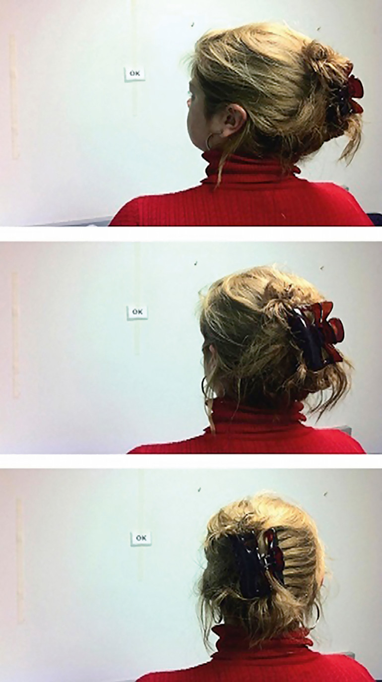 Pacjent stojący, kobieta, ćwiczenie adaptacji odruchu przedsionkowo-okoruchowego