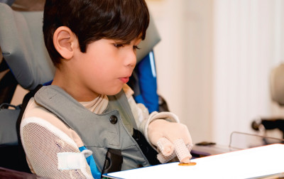 Dystonia podczas aktywności ręki u dzieci z jednostronnym spastycznym porażeniem mózgowym. Badanie obserwacyjne