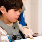 Dystonia podczas aktywności ręki u dzieci z jednostronnym spastycznym porażeniem mózgowym. Badanie obserwacyjne