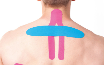 Kinestezjotaping