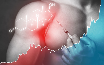 Pozytywna korelacja między zastrzykami sterydowymi a naderwaniem ścięgna mankietowego: Badanie kohortowe z wykorzystaniem klinicznej bazy danych