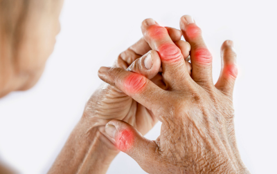 Zastosowanie pól magnetycznych w leczeniu pacjentów z reumatoidalnym zapaleniem stawów. Przegląd piśmiennictwa